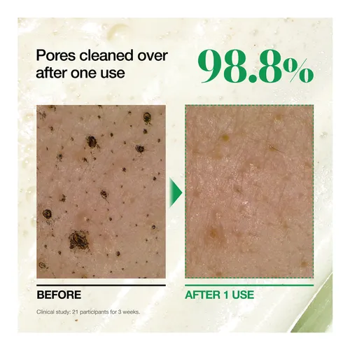 anua Heartleaf Quercetinol Pore Deep Cleansing Foam amorecity 2